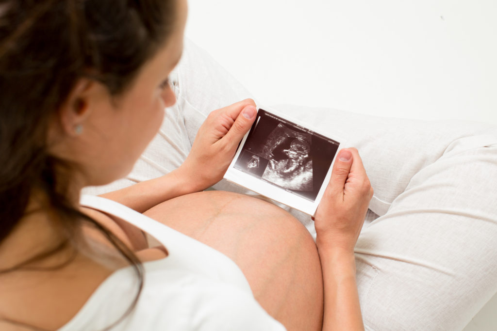 http://www.dreamstime.com/stock-images-pregnant-woman-looking-baby-ultrasound-scan-unborn-image33867654|Ovulations & sperm_diagram|Ovulations & sperm_diagram_with explanation|After Ovulations & sperm_diagram_with explanation |||