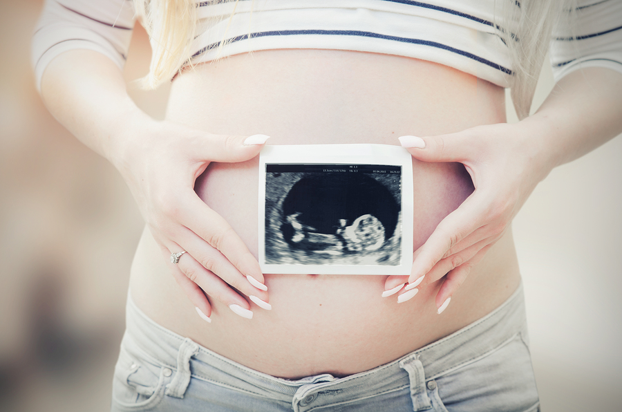 Pregnant woman holding ultrasound scan on her belly. pregnant ultrasound woman baby new scan fertility pregnancy concept